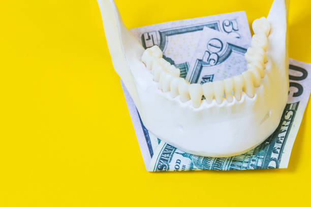 How much do partial dentures cost without insurance